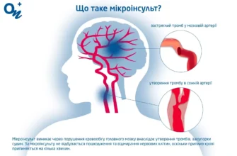 “Мікроінсульт: Наслідки, Які Варто Знати для Збереження Здоров’я” “Мікроінсульт: Наслідки, Які Варто Знати для Збереження Здоров’я”